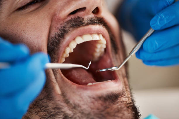 Best Emergency Dental Extractions in Line Acres, MO